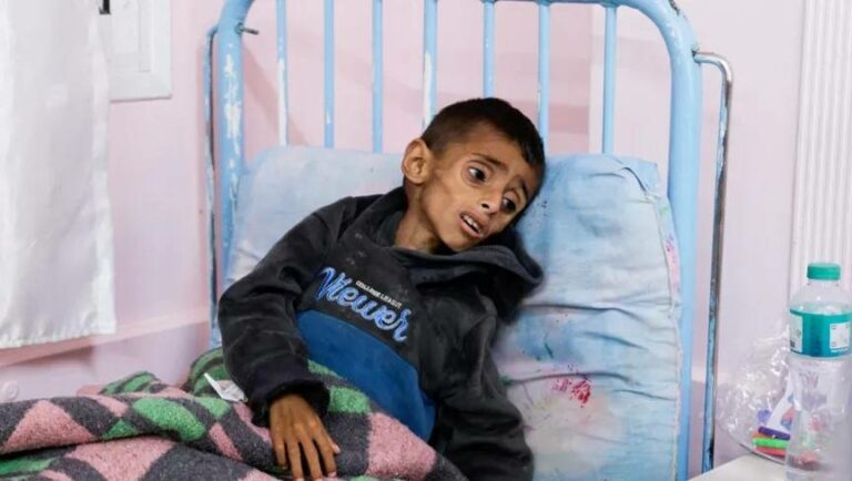 «الصحة-العالمية»:-أطفال-غزة-يتعرضون-للتجويع-والتدمير-الجسدي-ونحن-متواطئون