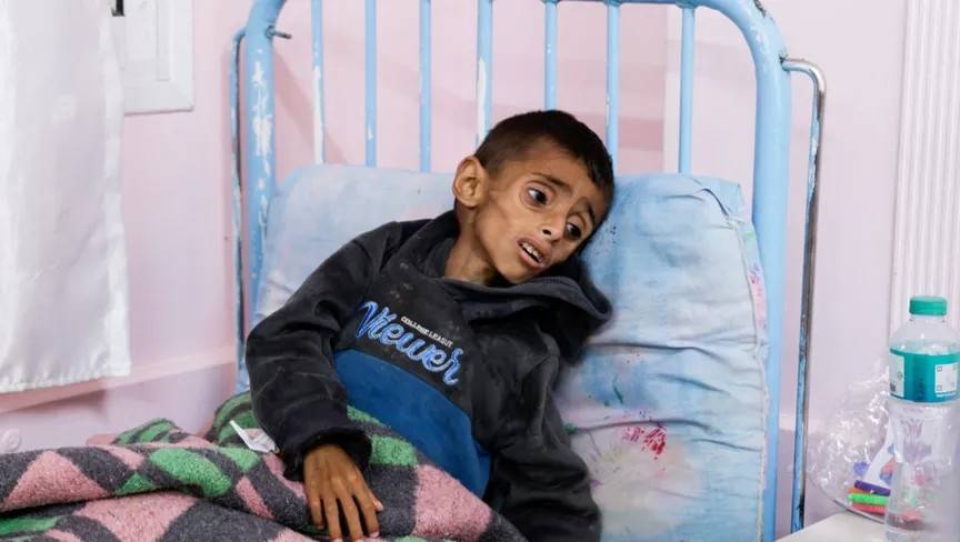 «الصحة-العالمية»:-أطفال-غزة-يتعرضون-للتجويع-والتدمير-الجسدي-ونحن-متواطئون