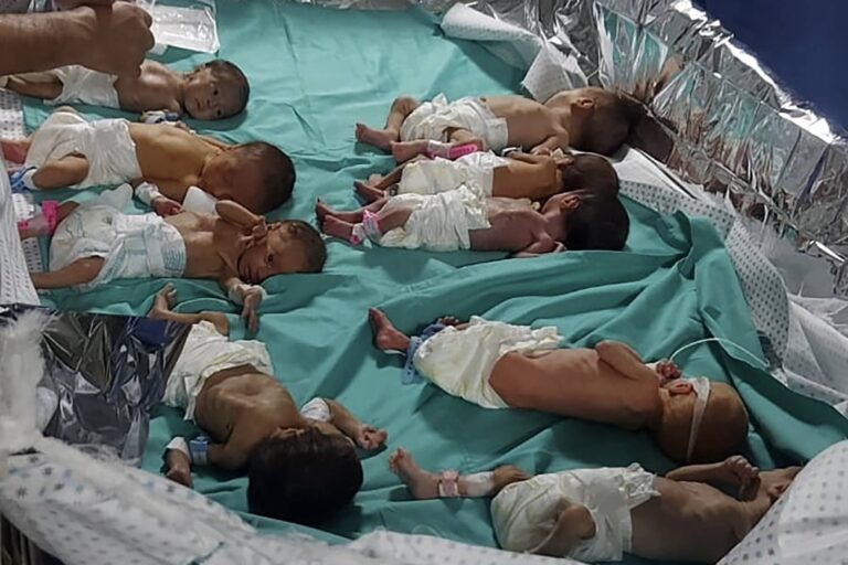 مستشفى-الشفاء-يعلن-وفاة-21-طفلا-جراء-التجويع-في-غزة