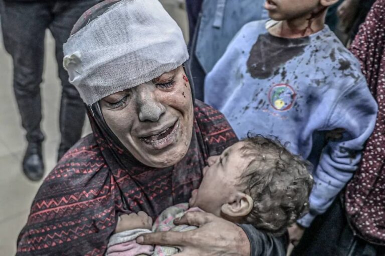 237222-شهيداً-وجريحاً-في-730-يوماً-من-حرب-الإبادة-الإسرائيلية-على-غزة
