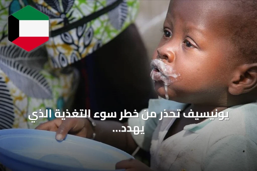 يونيسيف تحذر من خطر سوء التغذية الذي يهدد 1.9 مليون طفل صومالي