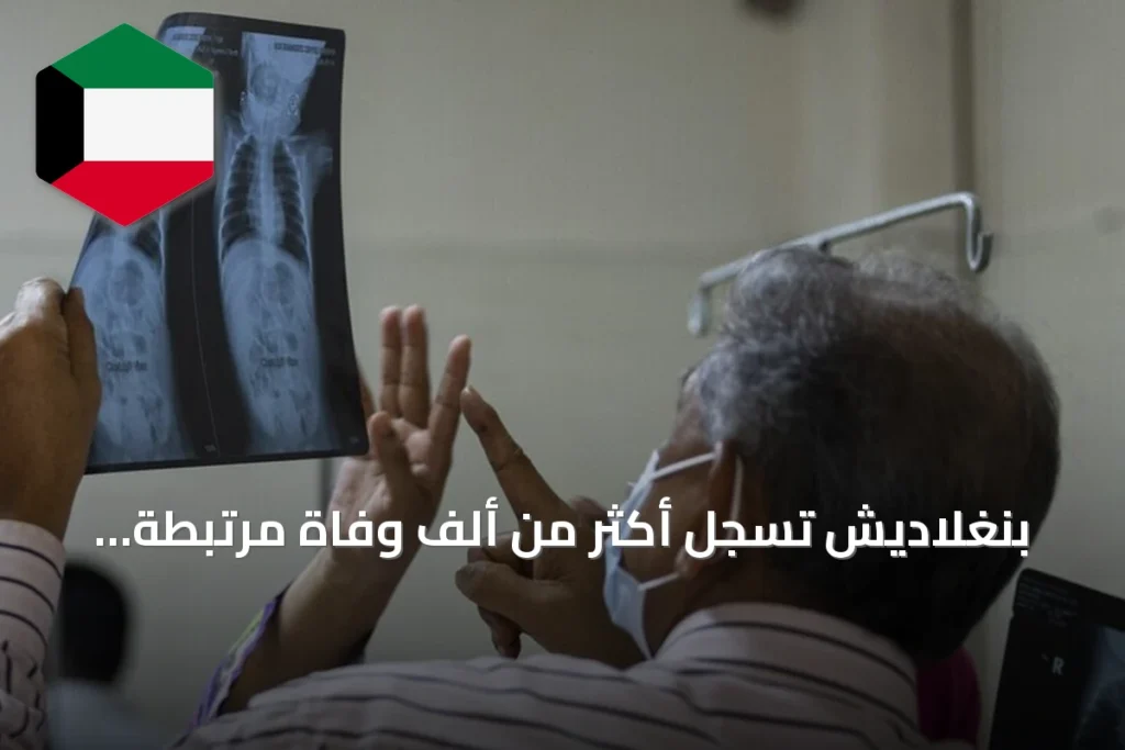 بنغلاديش تسجل أكثر من ألف وفاة مرتبطة بالحصبة مع استمرار تفشي المرض